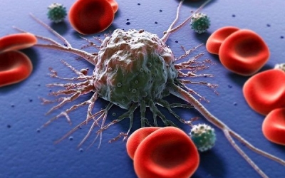 Phát hiện đột biến gen và chẩn đoán ung thư máu